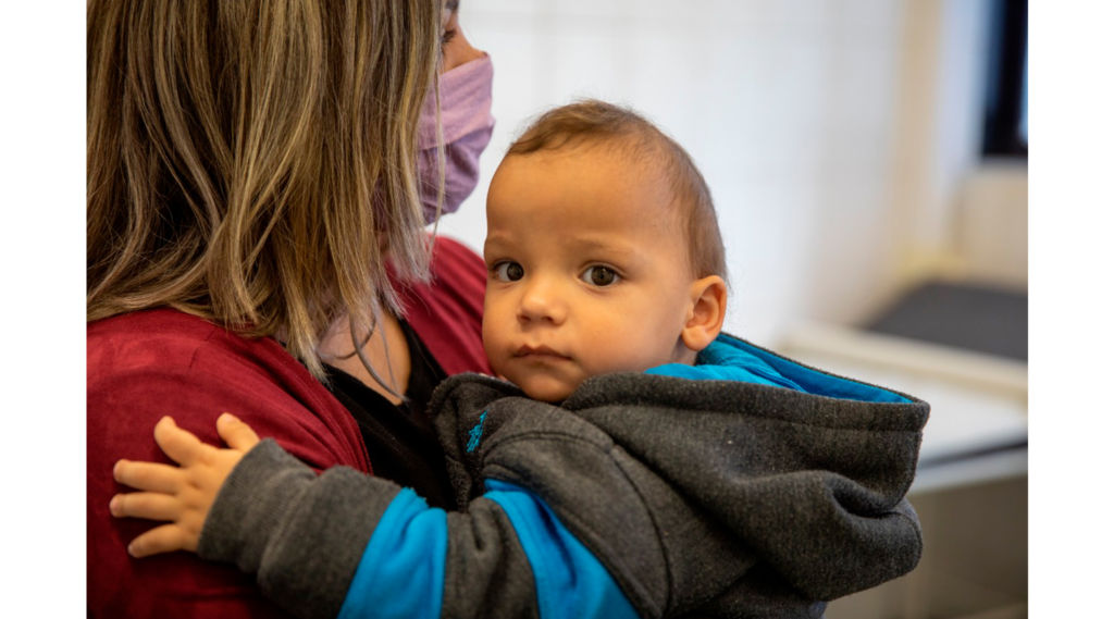 Escafocefalia: Conheça este tipo de cranioestenose