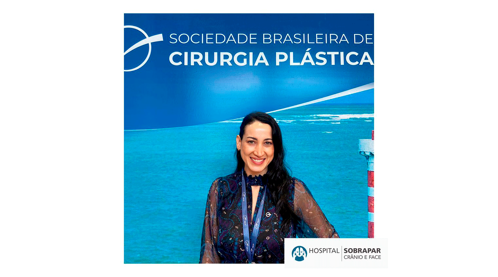 TRABALHO PREMIADO NO 57° CONGRESSO BRASILEIRO DE CIRURGIA PLÁSTICA