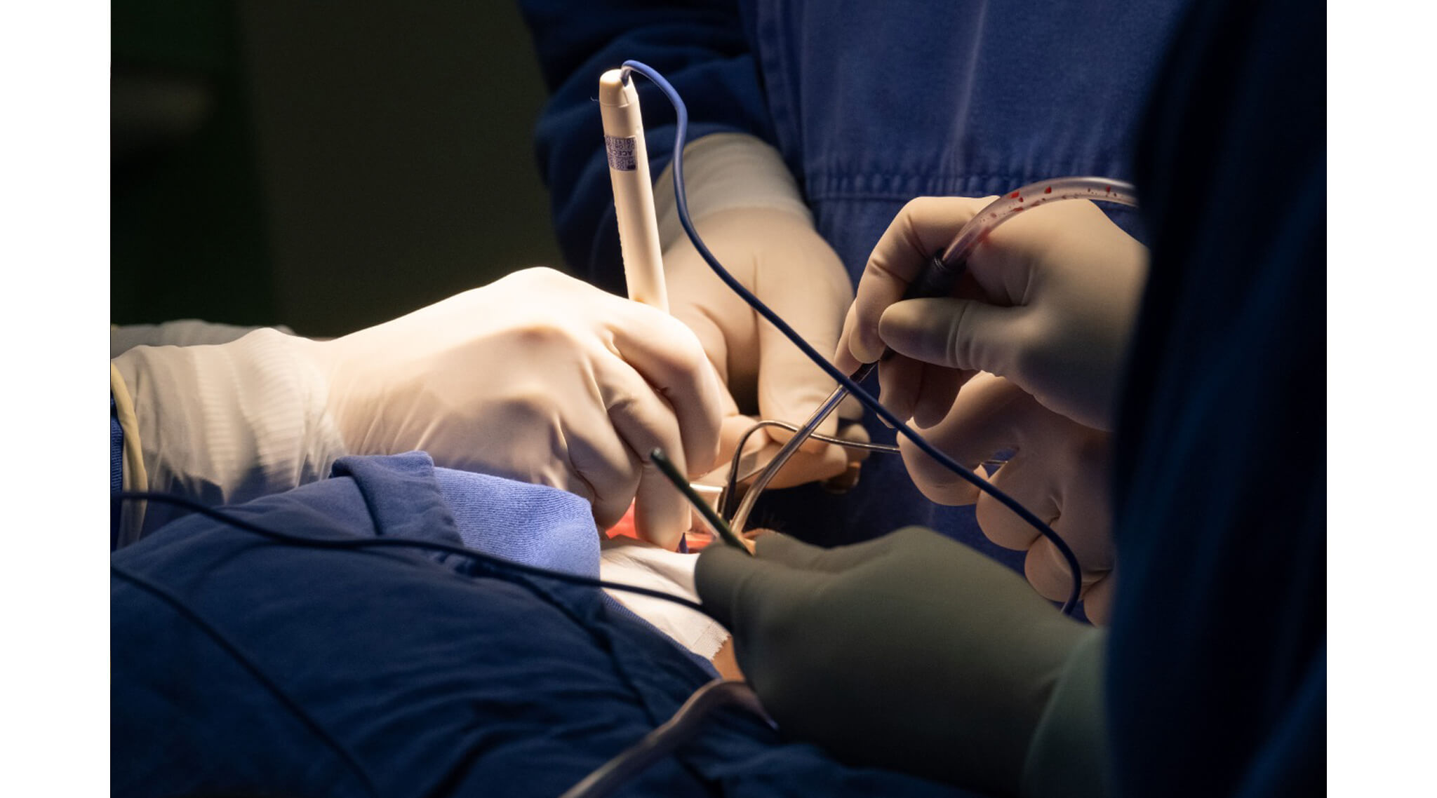 Síndrome de Saethre-Chotzen: entenda o tratamento e sintomas