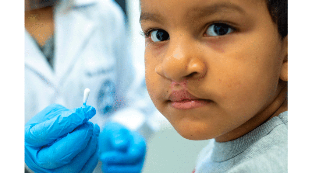 Correção estética no nariz após palatoplastia?