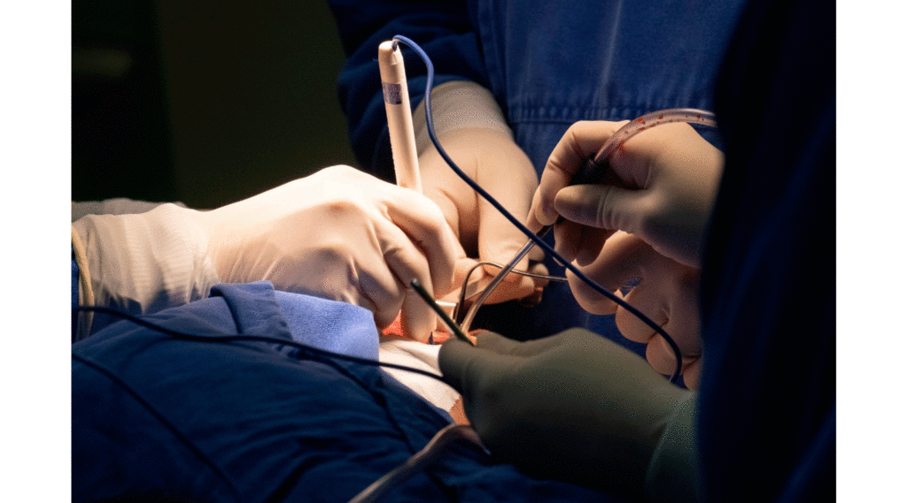 Mais sobre a cranioestenose na Sutura Lambdóide