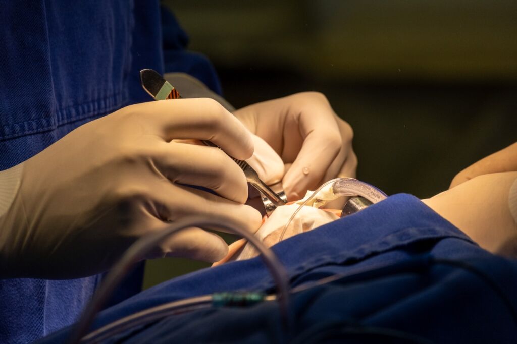 Como é feita a cirurgia de cranioestenose sindrômica