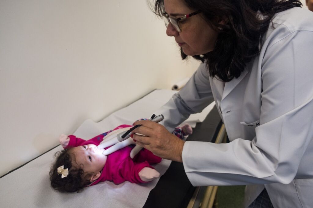 Língua presa e fissura de palato são comuns