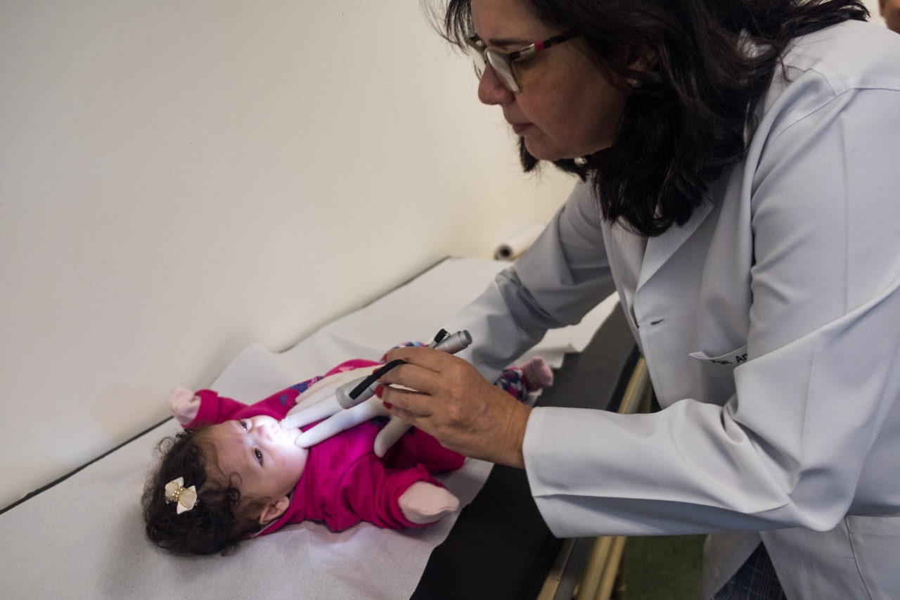 Língua presa e fissura de palato são comuns