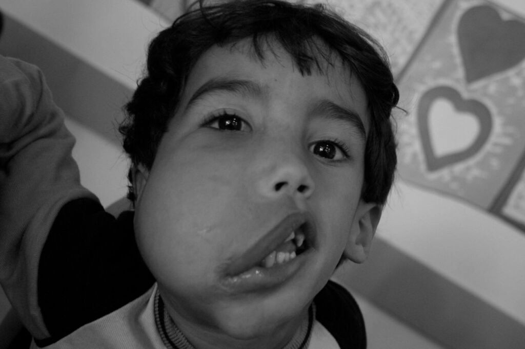 Dia Internacional de combate ao Câncer na Infância