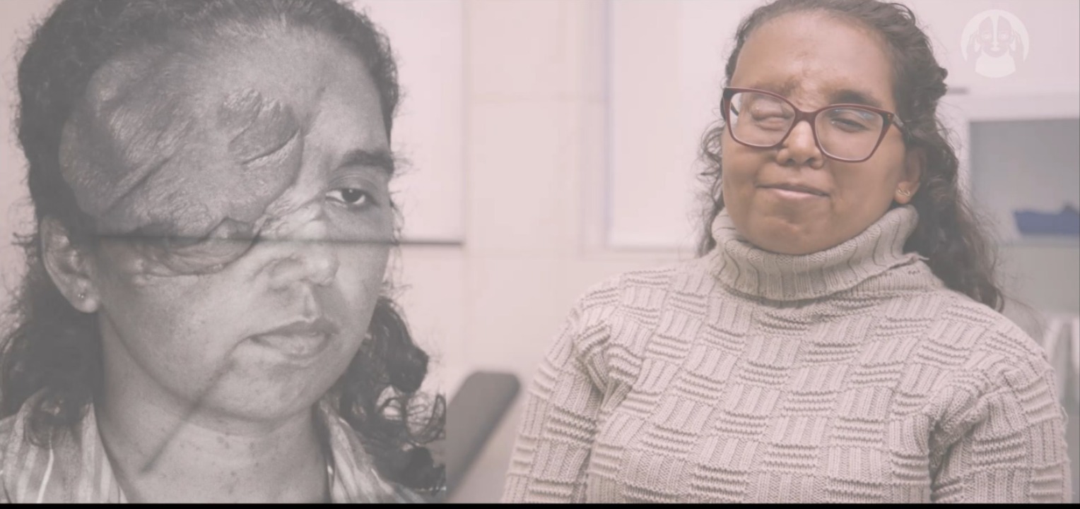 Anomalia Craniofacial e Tumores de Face: A História de Inez Nascimento Santos